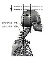 前方頭位図